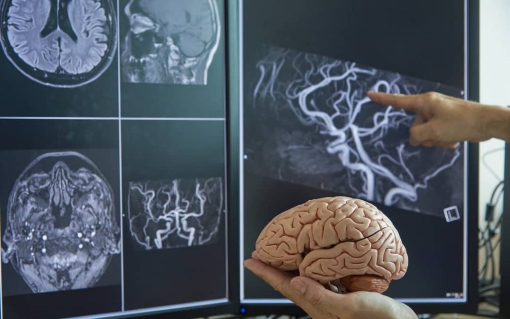 badania mózgu osoby z demencją